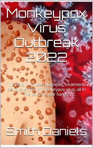 Monkeypox Virus Outbreak 2022: The history, causes, diagnosis, treatments and prevention of monkeypox virus, all in the palm of your hands.