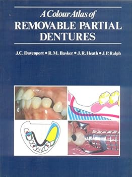 Paperback A Color Atlas of Removable Partial Dentures Book