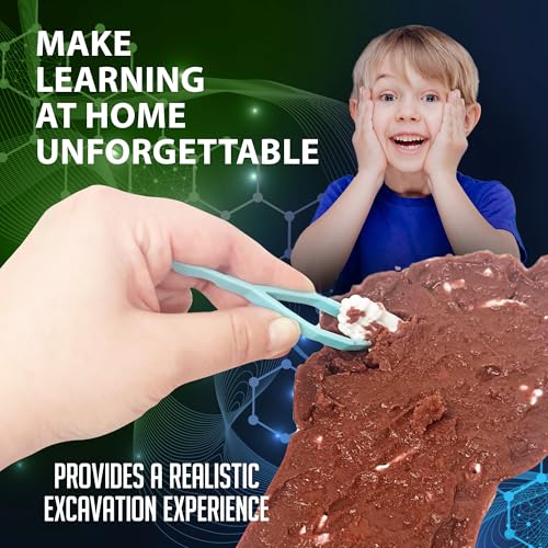 Image of Dissect-It Discover-It Bigfoot Dig Kids Science Kit, Gel Dissection Kit for Kids to Learn Anatomy, STEM Toys for Ages 6 and Above