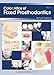 Color Atlas of Fixed Prosthodontics, Vol 2