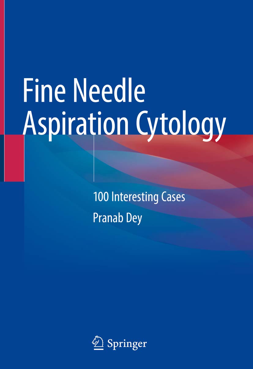 Fine Needle Aspiration Cytology: 100 Interesting Cases