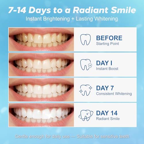 Image of Teeth Whitening Strip 14 Treatments - Whitening Strips for Sensitive People, Fast Remove Smoking, Coffee, Wine Stains, Teeth Brightening Kit Pack of 28 Non-Slip Strips