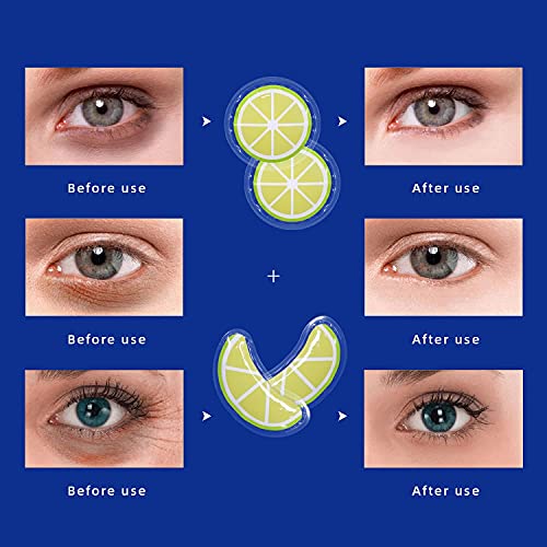 Gel Ice Pack Reusable Cooling Eye Pads And Under Eye Patches,Eye Hot Cold Treatment Pack For Redness,Pain Relief And Eye Relax #TOP6