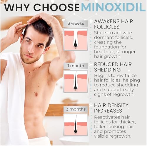 Image of Remixidil Men's 5% Minoxidil Foam Hair Regrowth Treatment for Men, 3 Month