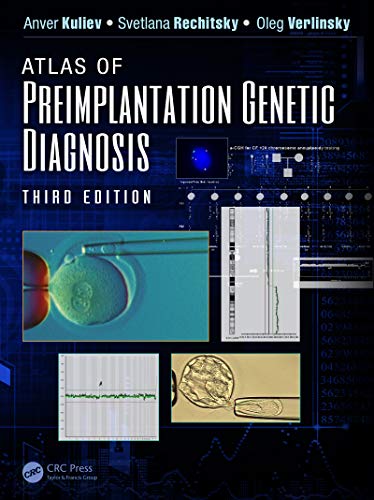 Atlas of Preimplantation Genetic Diagnosis (Encyclopedia of Visual Medicine Series)