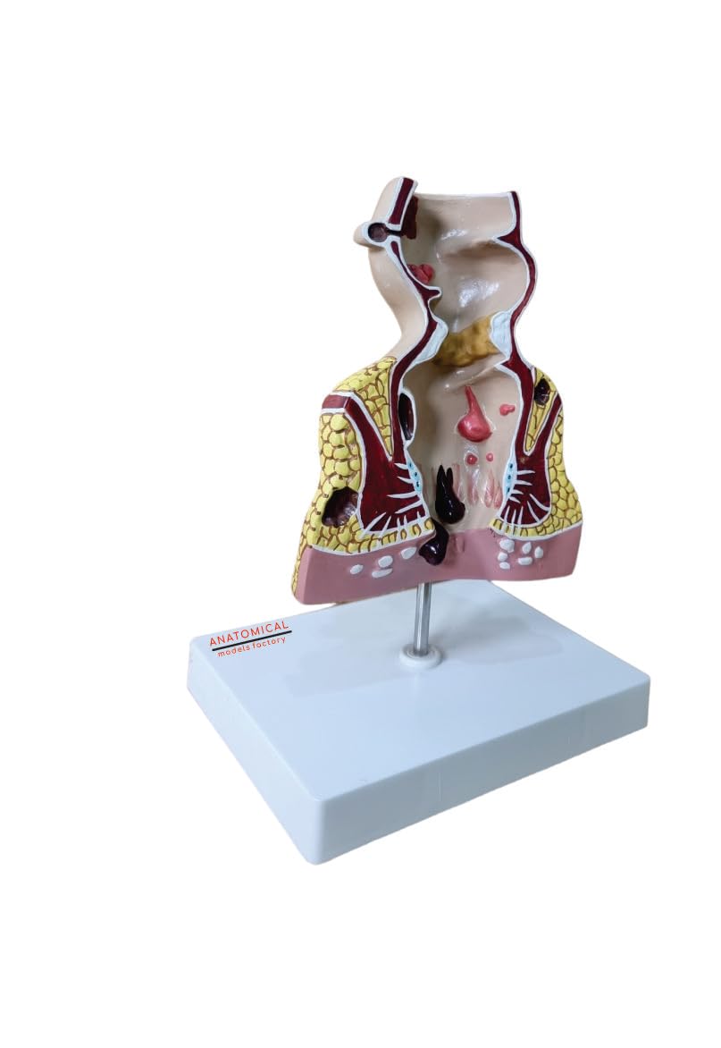 Buy Anatomical Models Factory Human Anorectal Pathological Model