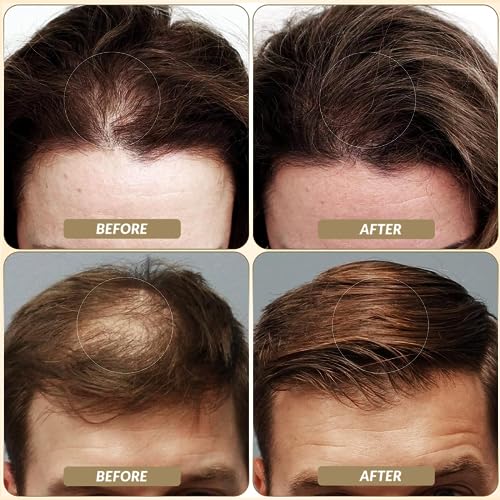 Sovoncare Hair Fibers For Thinning Hair Gray thumb #2