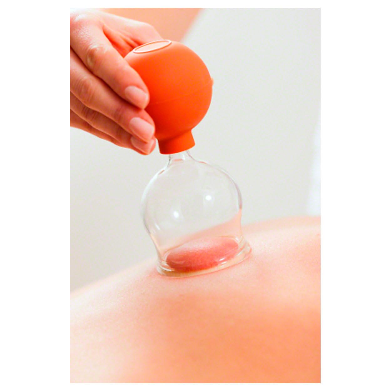 Sport-Tec Schröpfgläser mit Ball Schröpfglas Schröpfset mit Saugball ø 2,5-6,5 cm, 5er Set