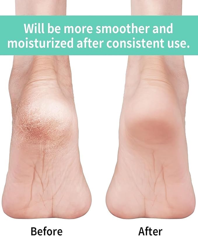 6 Pairs Moisturizing Feet Sleeve Gel Heel for Dry Cracked Heels, Spa Gel Socks, Open Toe Socks for Men Women, White