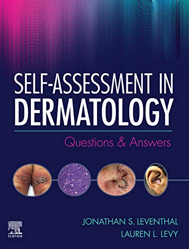 Self-Assessment in Dermatology E-Book: Questions and Answers Self-Assessment in Dermatology E-Book: Questions and Answers
