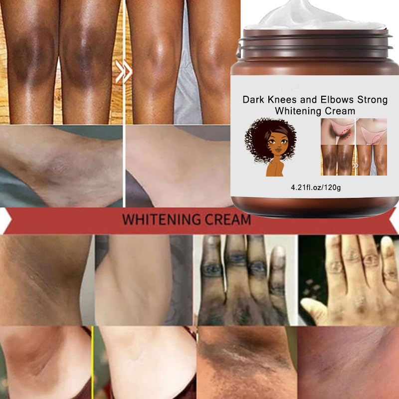 Miniatura 3 de 4.23 oz Crema Para Aclarar Las Axilas Y Partes Intimas, Para Piel Entrepierna, Manchas Codos, Piernas Zonas, Íntimas Cara Axilas, Cuello Rodillas