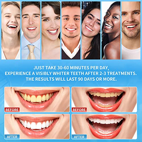 Image of Teeth Whitening Strips - DeepKlean White Strips for Removing Years Stains, Enamel Safe, 3 Days Express Result, 28 Teeth Whitener Strips for Teeth Sensitive 14 Treatments Peppermint Non-Slip Strips