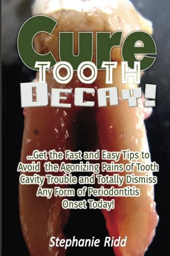 Cure Tooth Decay!: Get the Fast and Easy Tips to Avoid the Agonizing Pains of Tooth Cavity Trouble and Totally Dismiss Any Form of Periodontitis Onset Today!
