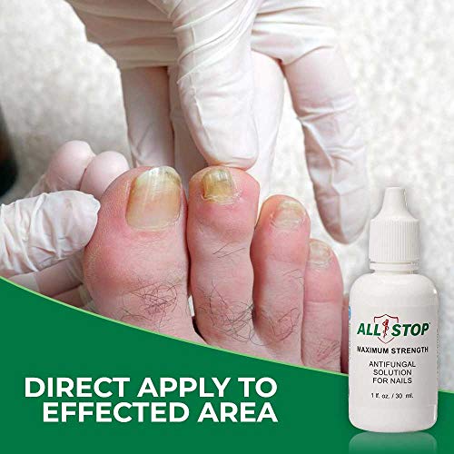 Antifungal Nail Fungus Treatment for Finger & Toe Nail- 1 Fluid Ounce