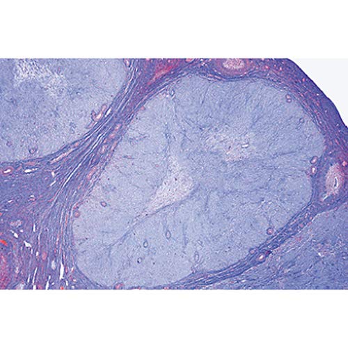3B Scientific GmbH W13417 Endocrine System Micro. Slides/Set of 5, Grade: 1 to 2