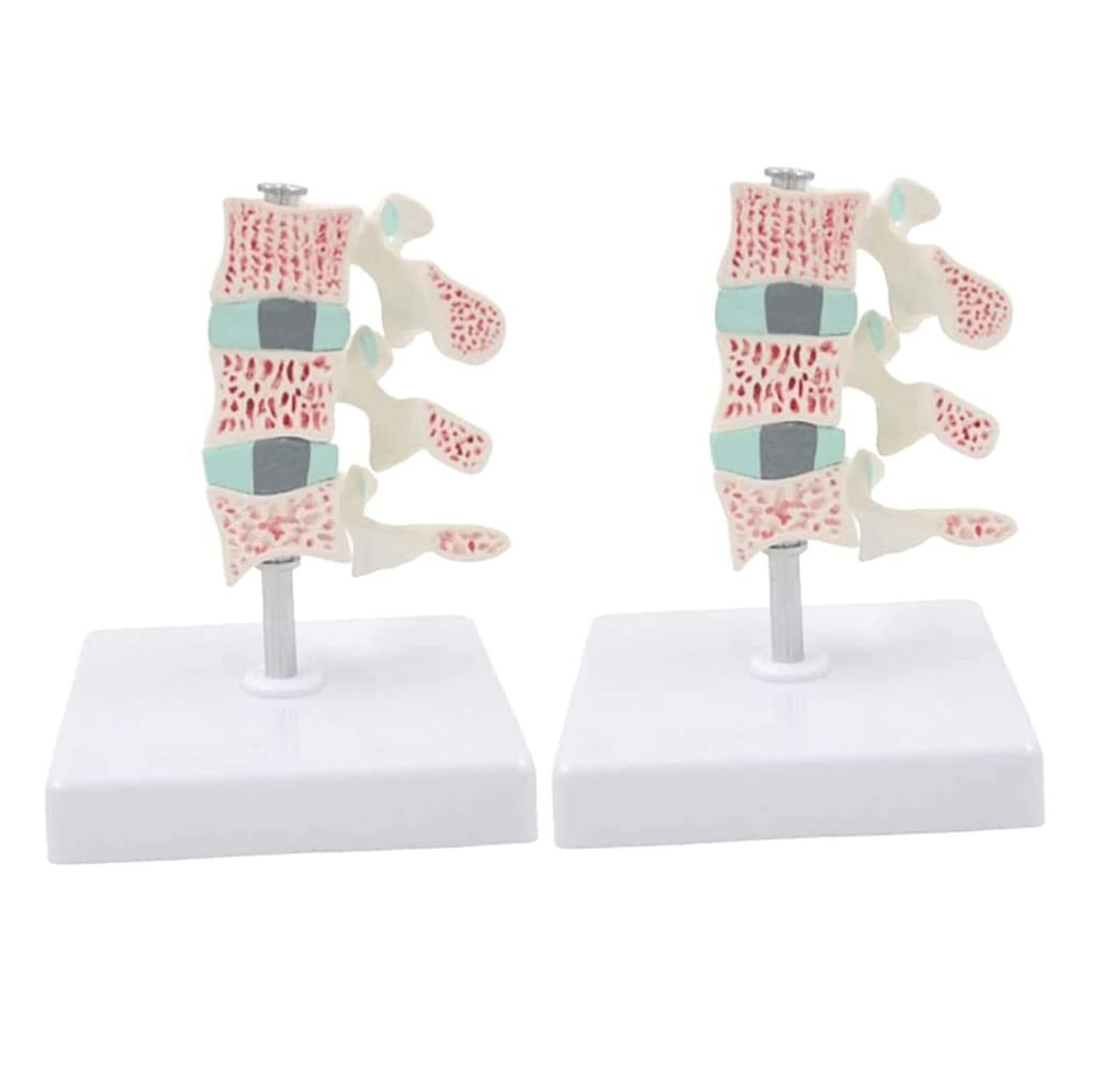 Modelo de Columna Vertebral Humana, Modelo de osteoporosis, Modelo anatómico con órganos de Columna Vertebral Humana extraíbles, Modelo anatómico for Oficina y Estudio de Estudiantes