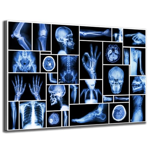 Large Abstract Skull Canvas Art Wall Décor