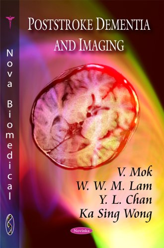 Poststroke Dementia & Imaging view 2