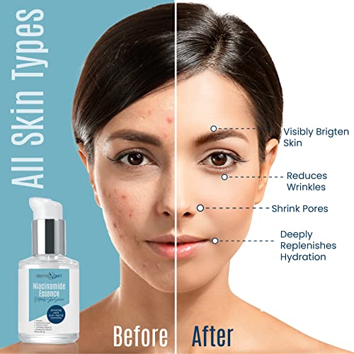 Dermaxgen Niacinamide Serum For Smooth, Bright & Youthful Skin, Pore Reducer + Uneven Skin Tone Treatment, Treat Dark Spots, Diminishes Acne Prone, Skin Balancing, Restores Elasticity. (2 Fl Oz) #TOP4