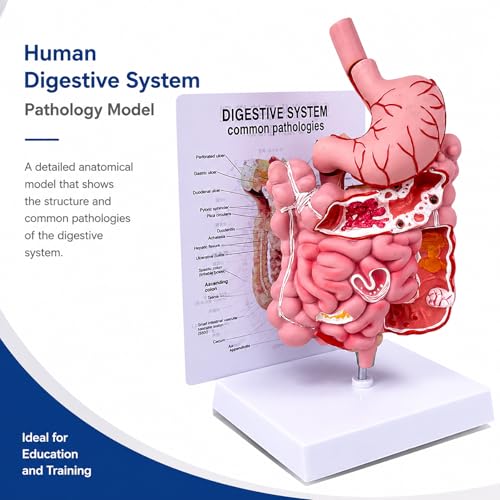 Image of Human Digestive System Model with Removable Stomach, GI-Tract and Colon, Includes Product Manual