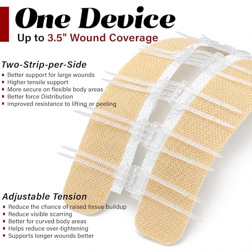 Image of EVERLIT Wound Closure Kit | Surgical Zip-Stitch Devices for Cut & Laceration | Sterile, Suture-Free, Stitch-Less Adhesive Butterfly Bandages for Emergency First Aid Wound Care (Ultimate Pro+ Kit)
