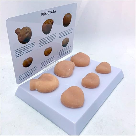 Prostate Model Prostate Lesion Model Medical Anatomical Prostate