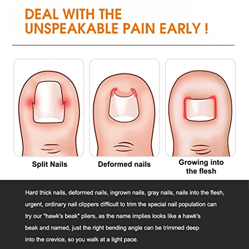 Image of MAYCREATE Ingrown Toenail Clippers for Ingrown or Thick Toenails,Wide Jaw Opening Nail Clippers with Curved and Slant Straight Blade Edge, 6 PCS Stainless Steel Toe Nail Clipper for Men
