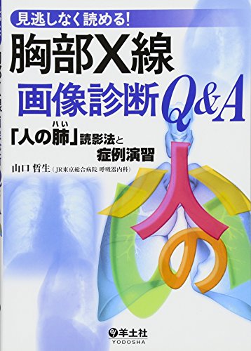 キンドル 無料電子書籍 見逃しなく読める!胸部X線画像診断Q&A―「人の肺」読影法と症例演習 バイ