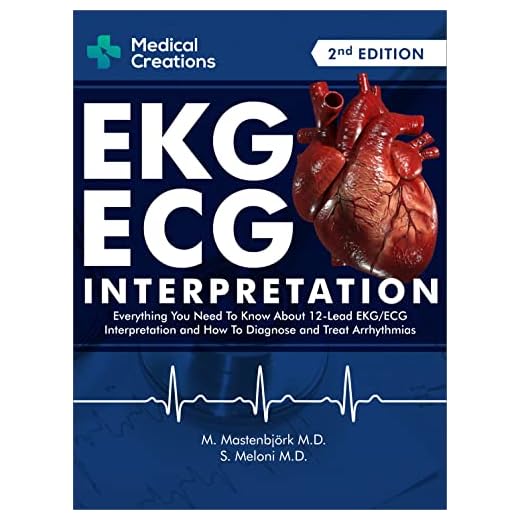 EKG/ECG Interpretation: Everything you Need to Know about the 12 - Lead ECG/EKG Interpretation and How to Diagnose and Treat Arrhythmias: 2nd Edition