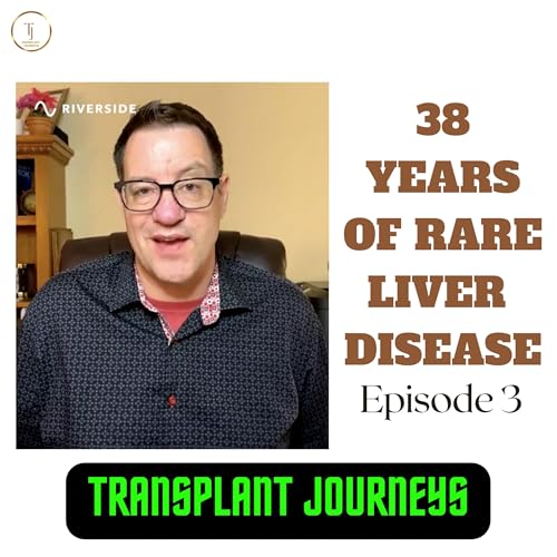 Activities you can do post transplant