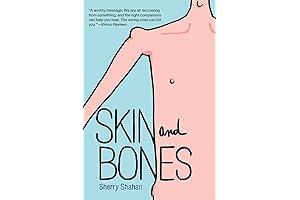 Skin and Bones: A Memoir