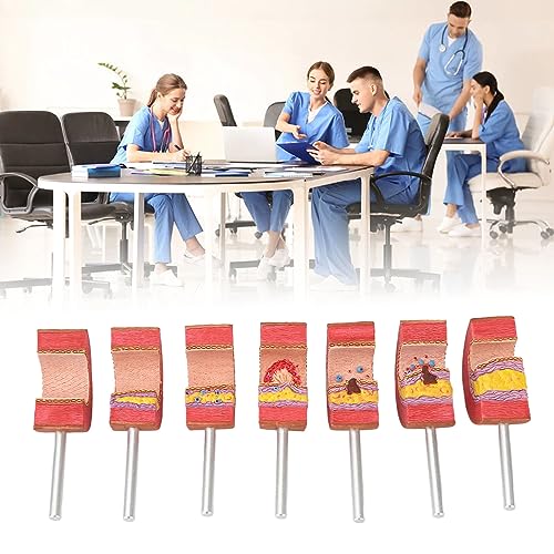 Image of 7PCS Artery Anatomy Model with Atherosclerosis Thrombus Vascular Model for Doctors, Educational Tool