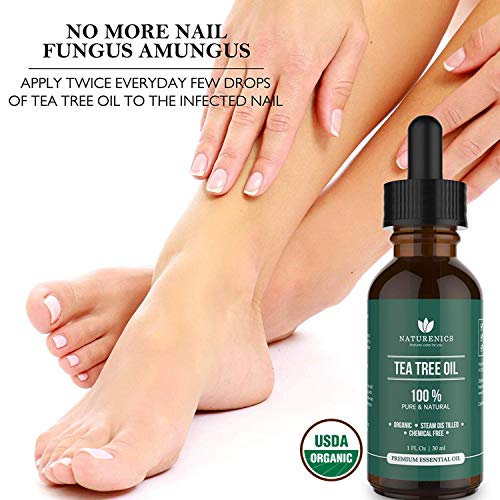 Naturenics Tea Tree Essential Oil-100% Usda Organic Melaleuca Alternifolia Therapeutic Grade- Natures Solution For Acne, Toenail, Lice, Hair, Face, Skin Problems-Roll On & Ebook-1 Fl Oz #TOP1