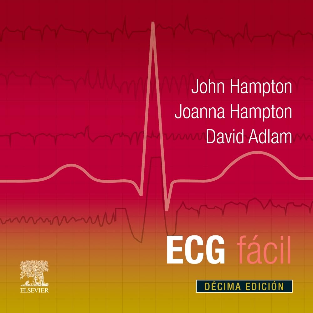 ECG fácil