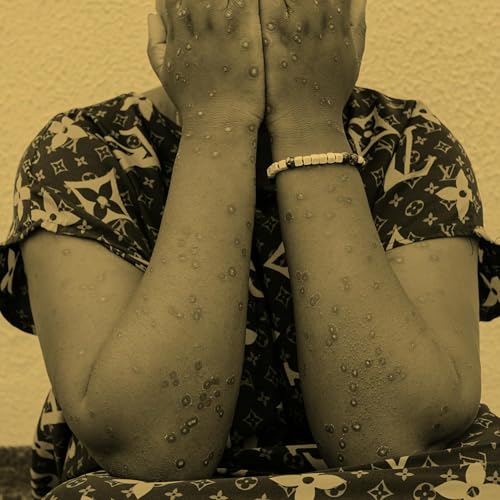 『The Path Toward Eliminating Neglected Tropical Diseases』のカバーアート