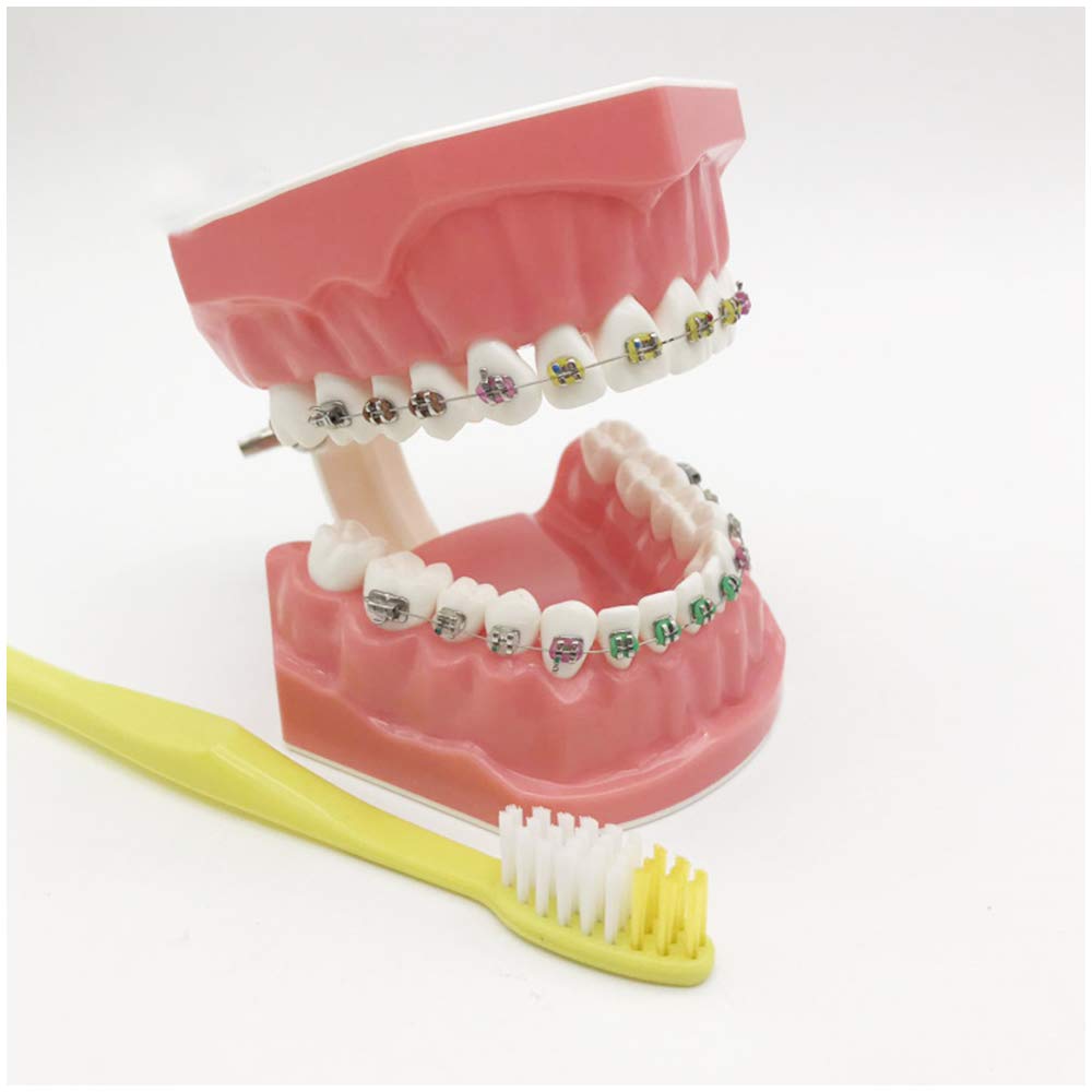 Modello Di Denti Per La Formazione - Modello Ortodontico - Modello Di Insegnamento Dei Denti Con Staffa In Metallo E Ceramica - Modello Di Formazione Correttiva Dei Denti Per L'insegnamento Dell'igien