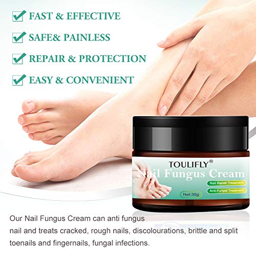 Nail Fungus Cream,Toenail Fungus Treatment,Nail Fungus Remover,Toenail Fingernail Fungus Remover Fungus Stop Cream