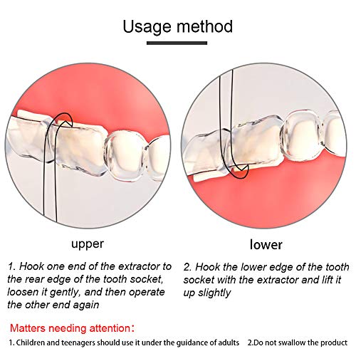 Image of 10PCS Aligner Removal Tool,5 Colors Portable Aligners Remove Hook Braces Removal Kit for for Invisible Braces