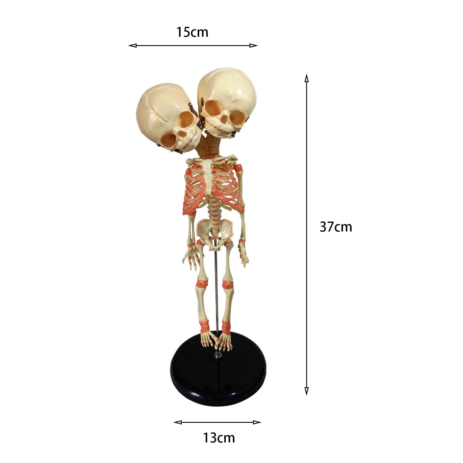 Amazon.com: SGeneE Two Headed Baby Skeleton Model Human Anatomical
