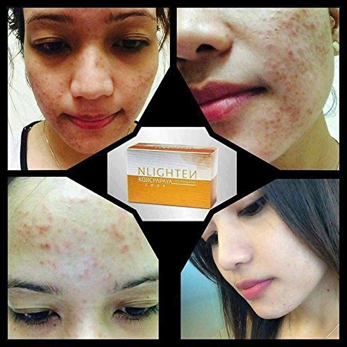 NLIGHTEN KOJIC PAPAYA SOAP (3 BARS) w/GLUTATHIONE BY NWORLD: Buy Online at  Best Price in UAE