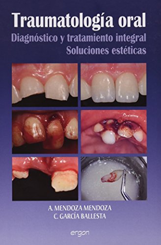 Traumatología oral: diagnóstico y tratamiento integral : soluciones estéticas