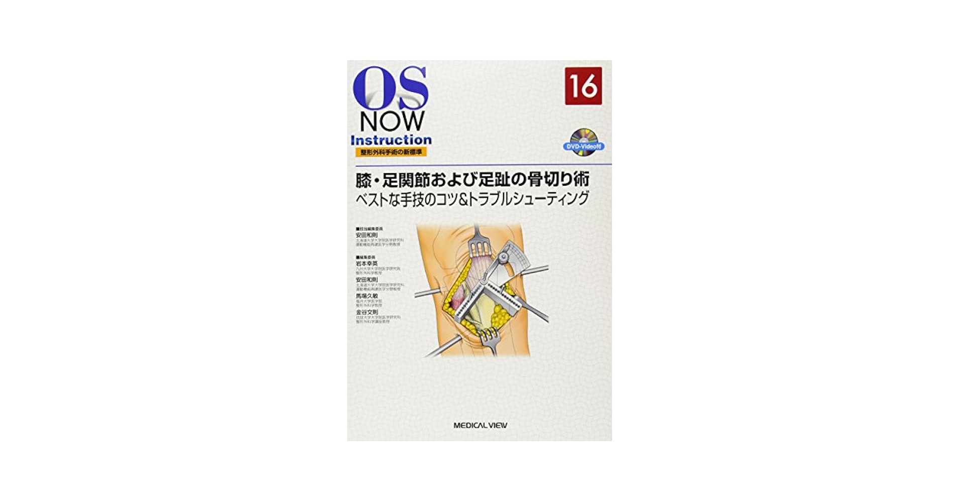 膝・足関節および足趾の骨切り術?ベストな手技のコツ&amp;トラブルシューティング [DVD付] (OS NOW Instruction) 安田 和則 膝・足関節および足趾の骨切り術−ベストな手技のコツ&トラブル
