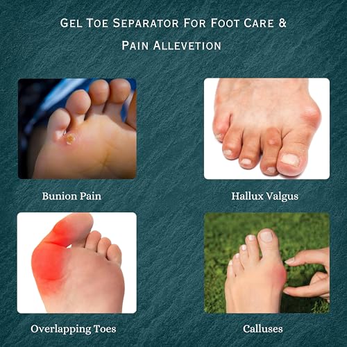 Image of Wonder Care Silicone Toe Separator For Feet Gel Pads Big Toe Corrector Bunion Straightener Yoga Stretcher Hammer Bunion [Pink,Pair of 3-6 Pieces]