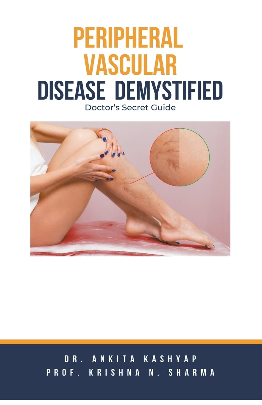 Peripheral Vascular Disease Demystified: Doctor's Secret Guide