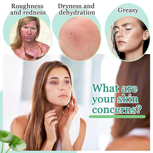 Wlglingui 4Pcs Aloe Vera Gel Moisturizer For Face,Hydrating Fast Absorbing Face Moisturizer After Sun Care,Moisturizing Long Lasting Non-Sticky Travel Size Aloe Vera Gel For Sunburn Relief thumb #4