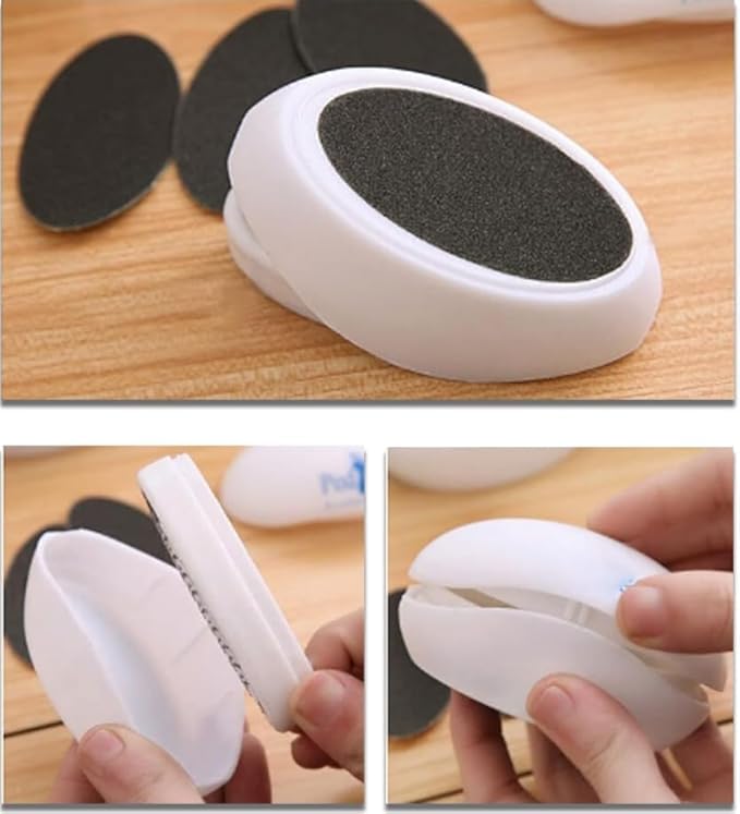 Xeerabdi Foot Scrubber Egg Shape | Pedicure Callus Remover Tool | Dry, Cracked Heels Smooths Feet with Gentle Exfoliation | Compact, Ergonomic & Easy to Clean 2