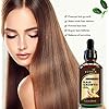 Hair-Growth-Serum-Votala-Hair-Growth-Treatment-Hair-Serum-Anti-Hair-Loss-Thinning-Balding-Repairs-Hair-Follicles-Promotes-Thicker-Stronger-Hair-And-Promotes-Hair-Regrowth Hair Growth Serum, VOTALA Hair Growth Treatment, Anti Hair Loss, Promotes Thicker, Stronger Hair, And Hair Regrowth for Men Women