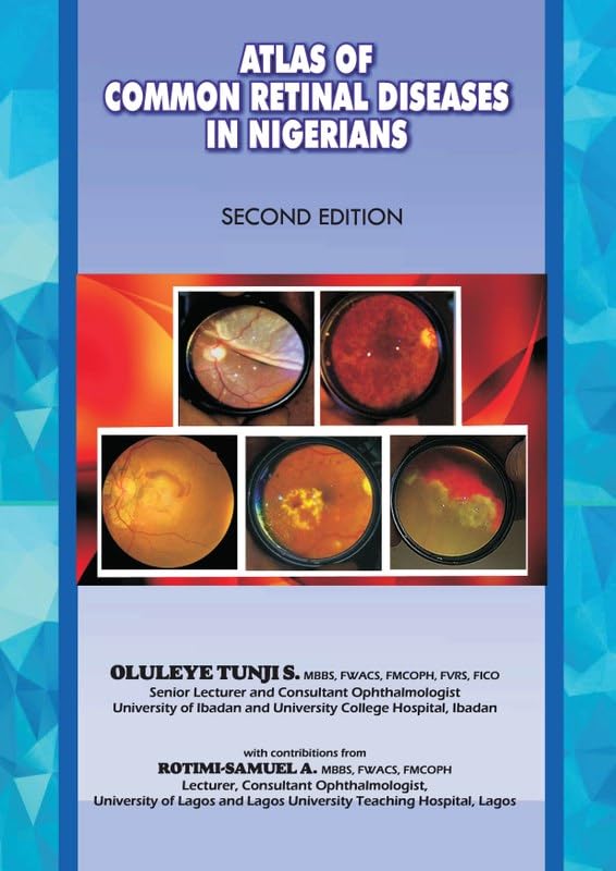The Atlas of Retinal Diseases in Nigeria      [Print Replica] Kindle Edition