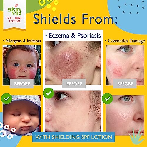Skin Md Shielding Lotion For Face, Body & Hands 4Oz + Spf 15 - Helps With Eczema & Psoriasis! The Dry Skin Remedy To The Things That Dry Your Skin #TOP4