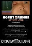 Agent Orange: 30 Years Later